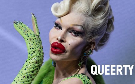 Amanda Lepore explains how being bullied as a kid inspired her: “I didn’t want to look like a basic girl”
