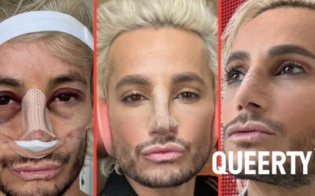 Frankie Grande wants to normalize rhinoplasty by bringing his followers along on his nose job journey