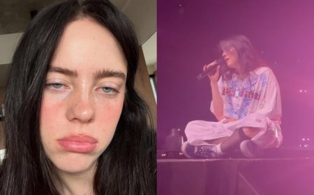 Billie Eilish hit in the face by bracelet during performance of What Was I Made For?