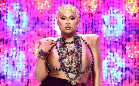 ‘Drag Race’ Star Jiggly Caliente Undergoes Leg Amputation Following Severe Health Complication