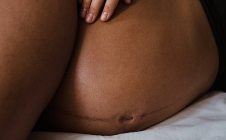 Why lesbians face a maternal healthcare crisis