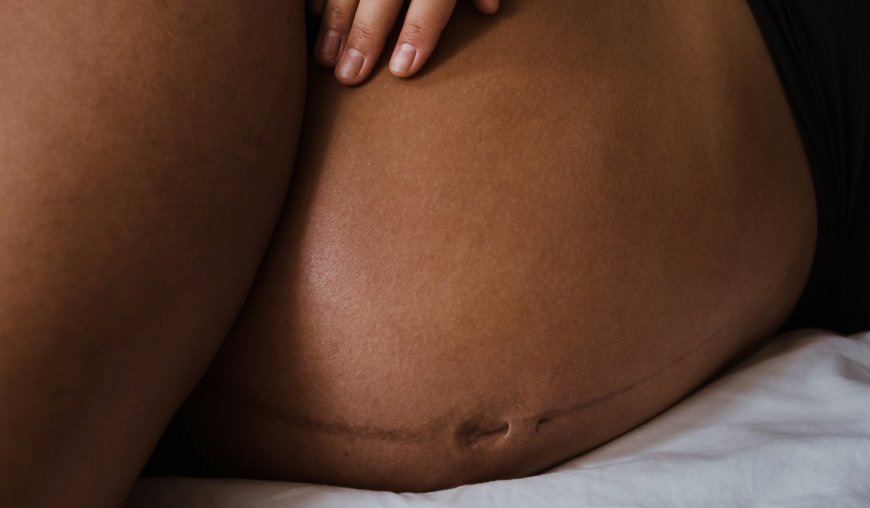 Why lesbians face a maternal healthcare crisis