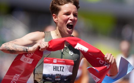 From one trans athlete to another: Joy and liberation of top surgery
