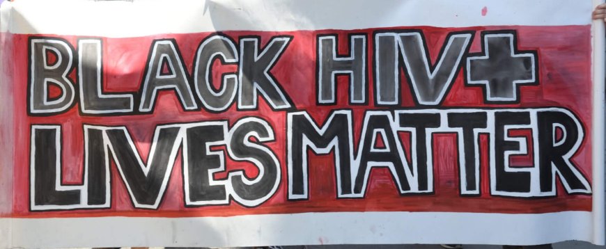 Four decades in, Black communities are still paying the highest price from HIV — and inaction is not an option